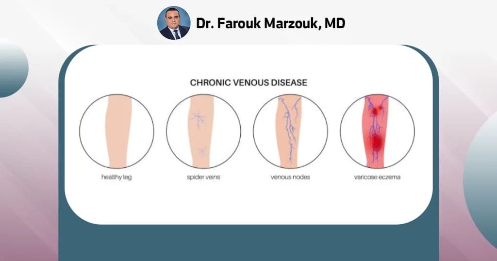 What is the difference between venous insufficiency and arterial insufficiency?