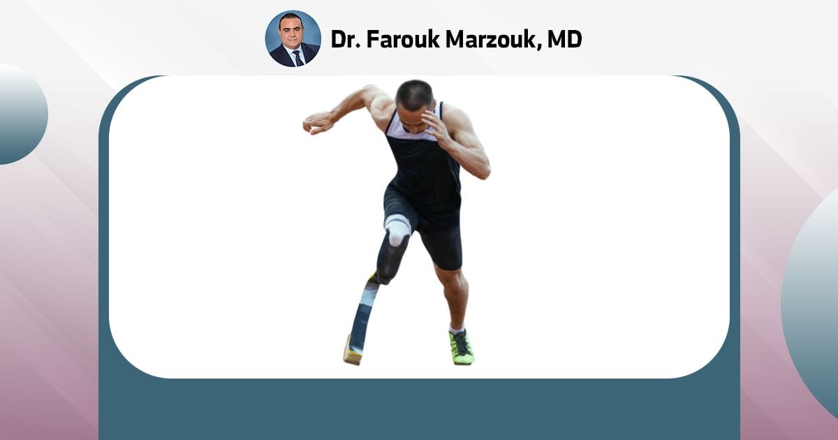 Through Knee Amputation