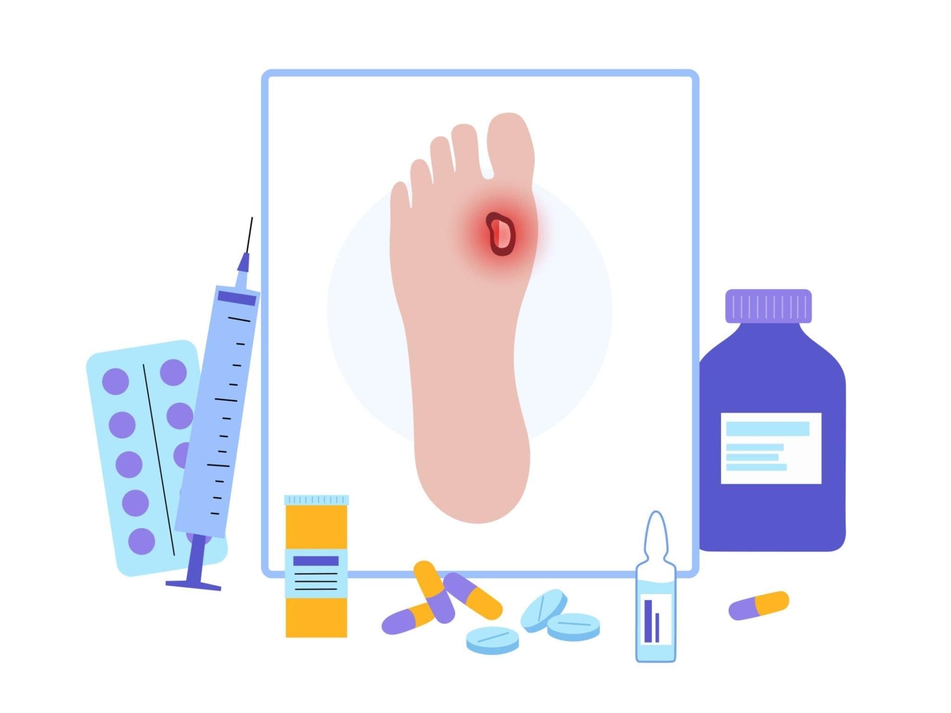 What is the cause of a venous ulcer?