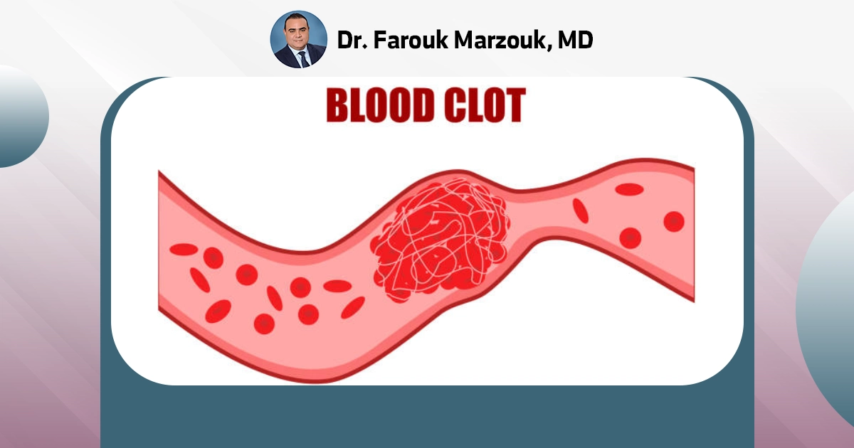 What are the first signs of a blood clot?