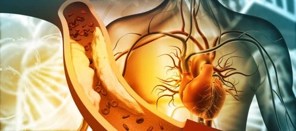 venous stents | How long do venous stents last? types of venous stents