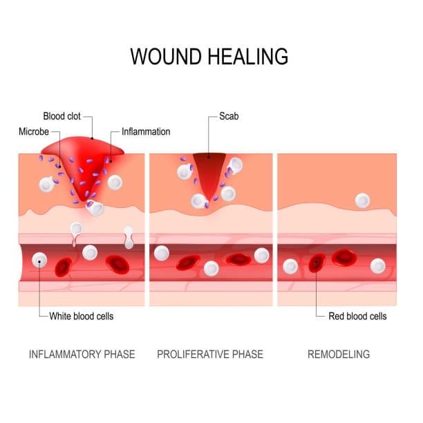 What Are the Stages of Open Wound Healing? Factors Affecting Wound Healing - dr farouk marzouk