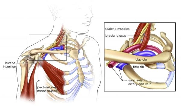 What are the red flags of thoracic outlet syndrome?
