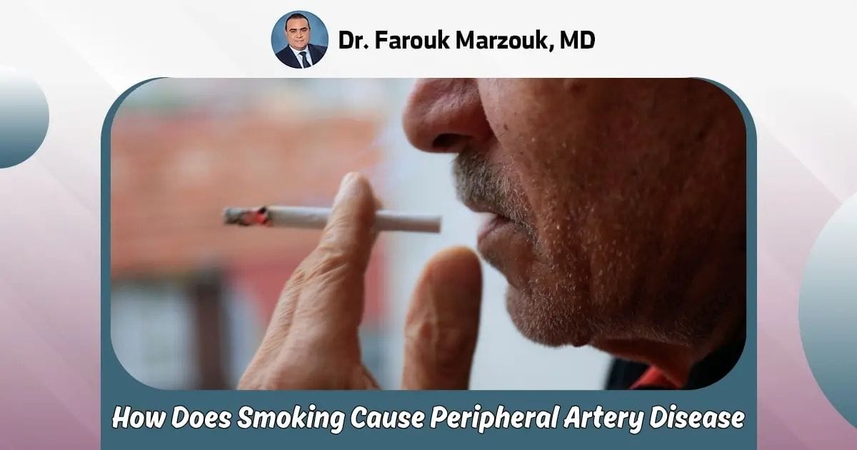How Does Smoking Cause Peripheral Artery Disease: Full Guide