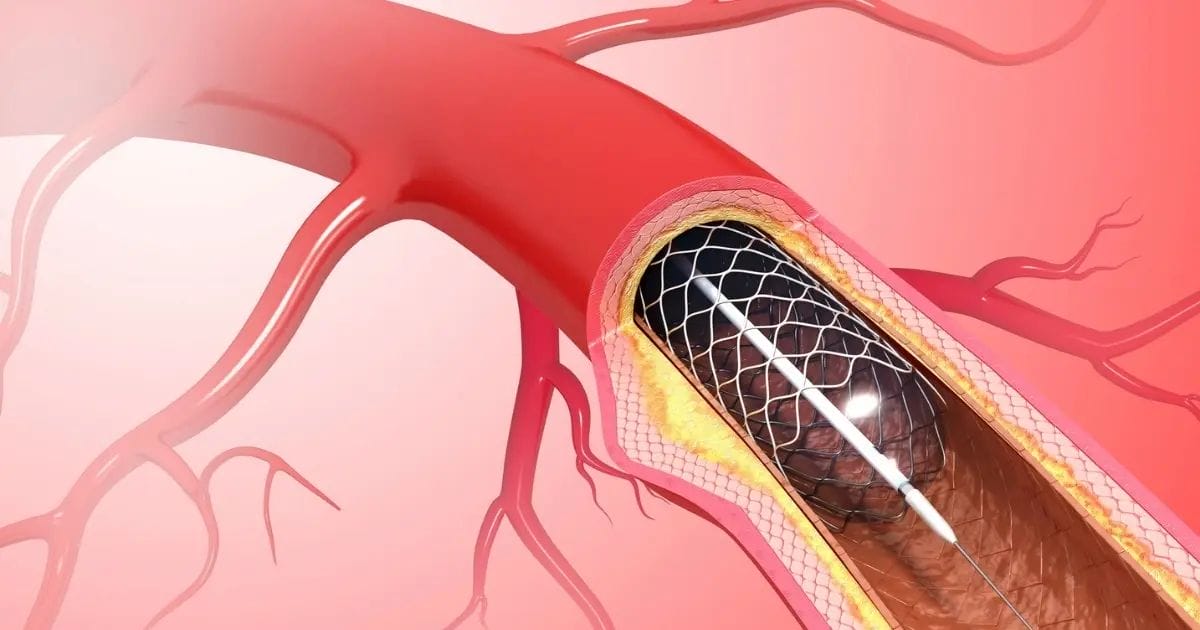 Benefits of Quitting Vaping