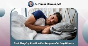 best sleeping position for peripheral artery disease