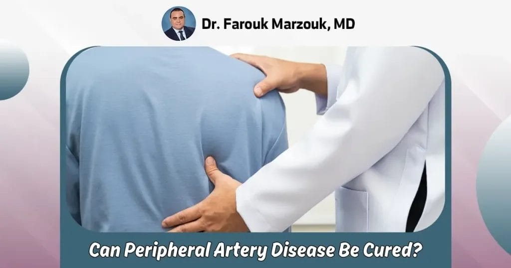 can peripheral artery disease be cured