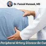 Can Peripheral Artery Disease Be Cured: Is PAD curable?