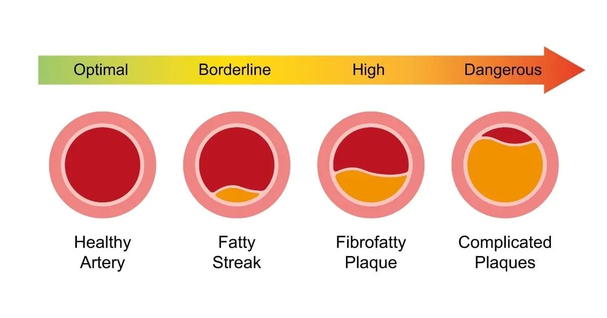 What Does PAD Pain Feel Like